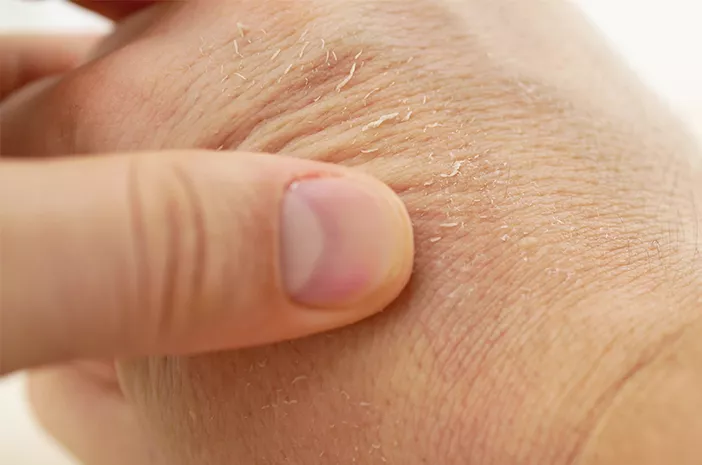 Cara mengatasi kulit kering di Arab